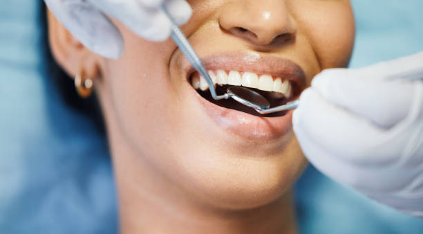 Best Emergency Dentist for Lost Fillings or Crowns in Brushy Creek, TX